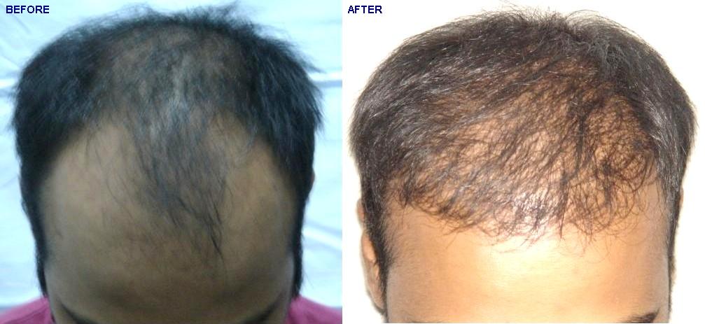 Before/After Result Image Before/After Result Image