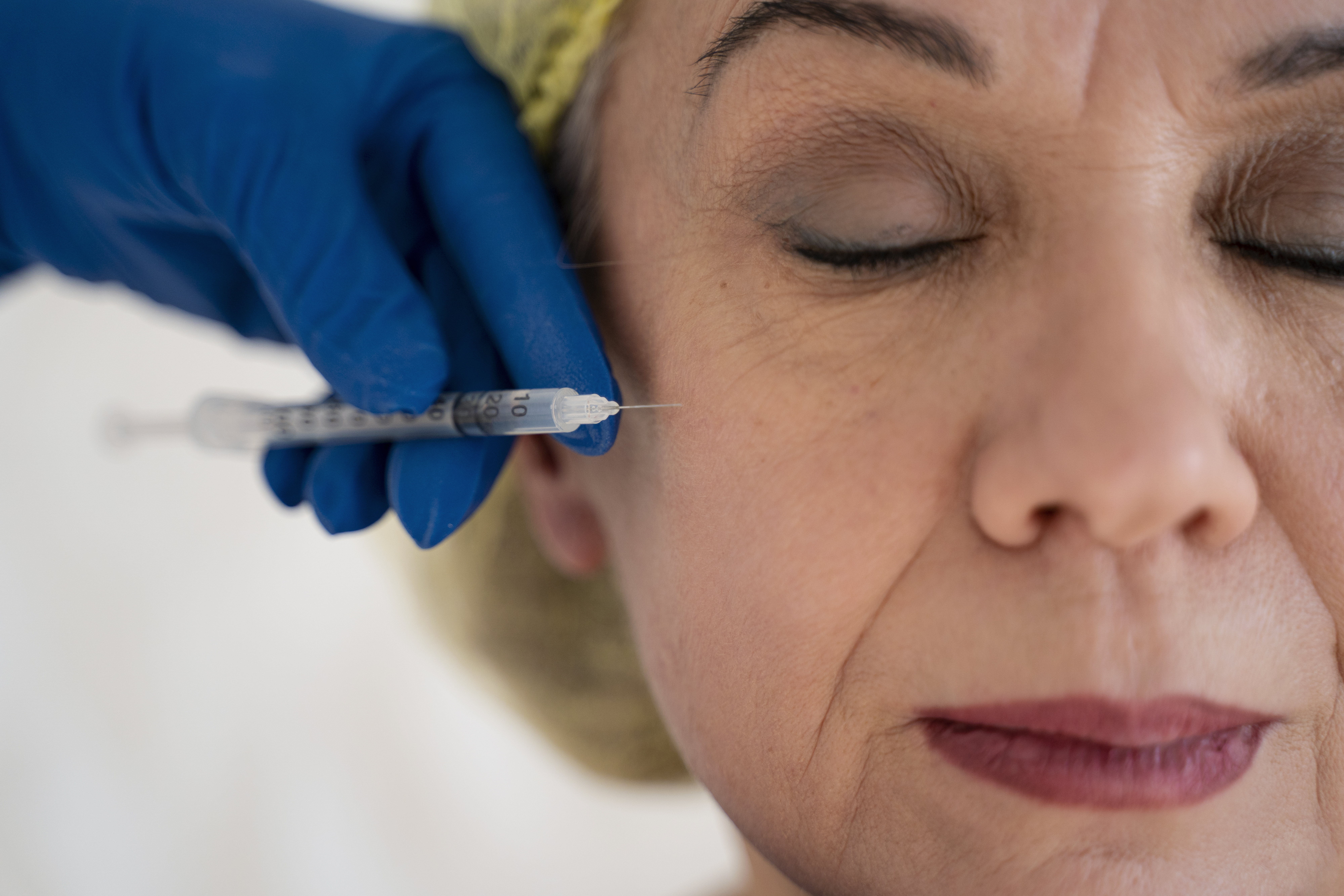 Stem cell mesotherapy in Thane Stem cell mesotherapy in Thane